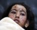 Le «serviteur» des Lieux-Saints de l’islam a assassiné 1 500 enfants au Yémen
